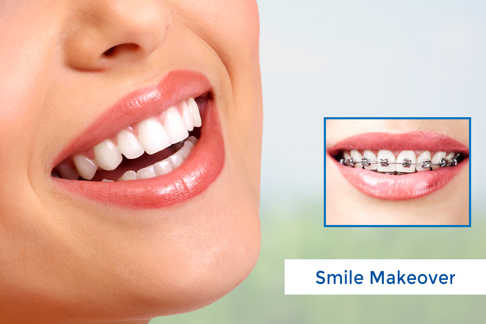 Cosmetic Dentistry Getaways: Smiling Brighter in Exotic Locations